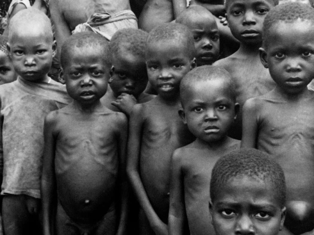 A Picture of Biafra Starvation 